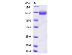 Sino Biological Human parainfluenza virus 4b (HPIV-4b) Hemagglutinin-neuraminidase