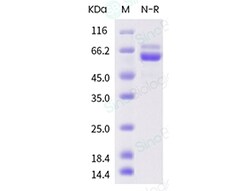Sino Biological Human respiratory syncytial virus (RSV) Fusion Protein