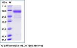 Sino Biological Influenza A H3N2 (A/Hong Kong/4801/2014) Neuraminidase