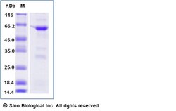 Sino Biological Zika virus (strain Zika SPH2015) E / Envelope protein (Domain