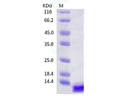 Sino Biological Zika virus (ZIKV) (strain Zika SPH2015) ZIKV-E / Envelope