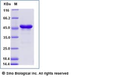 Sino Biological Zika virus (ZIKV) (strain Zika SPH2015) E / Envelope protein