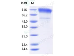 Sino Biological Human immunodeficiency virus HIV gp120 Protein (His & AVI