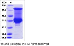 Sino Biological Recombinant P. falciparum PfLDH Protein (His Tag), Quantity: