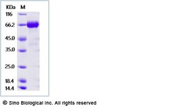 Sino Biological Influenza B (B/Victoria/02/1987) Hemagglutinin / HA Protein (ECD,