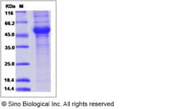 Sino Biological Influenza A H5N1 (A/Thailand/1(KAN-1)/2004) Neuraminidase