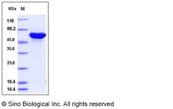 Sino Biological Influenza A H2N2 (A/Ann Arbor/6/1960) Nucleoprotein / NP