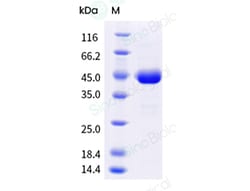 Sino Biological Vaccinia Virus B18R / B19R Protein (His Tag), Quantity: