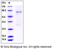 Sino Biological Human Enterovirus 71 VP0 Protein (His & GST Tag), Quantity: