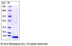 Sino Biological Influenza A H1N1 (A/Puerto Rico/8/34/Mount Sinai) Non-structural