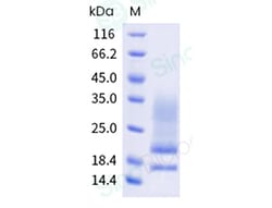 Sino Biological Recombinant Fraxinus excelsior Fra e 1 Protein, Quantity: