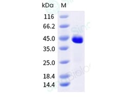 Sino Biological Recombinant Dermatophagoides pteronyssinus Der p 7 Protein,