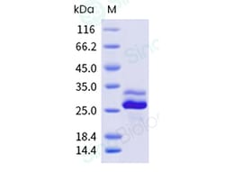 Sino Biological Recombinant Dermatophagoides pteronyssinus Der p 7 Protein,