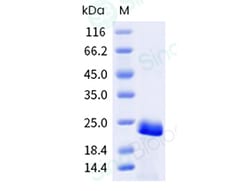 Sino Biological Recombinant Corylus avellana Cor a 1 Protein, Quantity:
