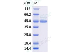 Sino Biological Recombinant Blattella germanica Bla g 2 Protein, Quantity: