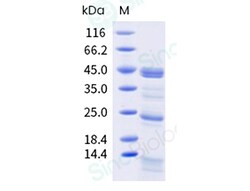 Sino Biological Recombinant Blattella germanica Bla g 1 Protein, Quantity: