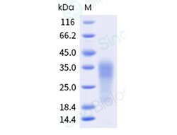 Sino Biological Recombinant Human MUC17 Protein (His Tag), HPLC-verified,