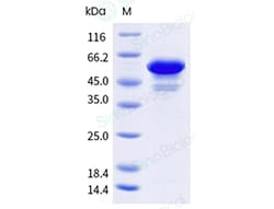 Sino Biological Human Tau / TAU410 Protein (isoform 2N3R, His Tag), Quantity:
