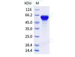 Sino Biological Human Tau / TAU441 Protein (isoform 2N4R, His Tag), Quantity: