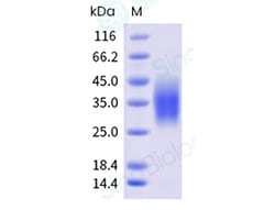 Sino Biological Recombinant Human GCGR Protein (His Tag), HPLC-verified,