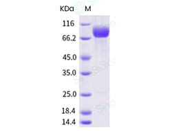 Sino Biological Recombinant Human SIRP alpha/SHPS-1 Protein (ECD, SIRP