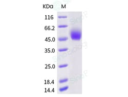 Sino Biological Recombinant Human SIRP alpha/SHPS-1 Protein (ECD, SIRP