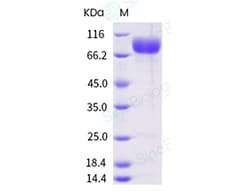 Sino Biological Recombinant Human SIRP alpha/SHPS-1 Protein (ECD, SIRP