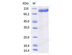 Sino Biological Recombinant Human ILT1/LILRA2/LIR-7 Protein (hFc Tag),