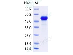 Sino Biological Human Tau / TAU412 Protein (isoform 1N4R, His Tag), Quantity: