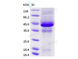 Sino Biological Recombinant Human TACI Protein (ECD, hFc Tag), Quantity: