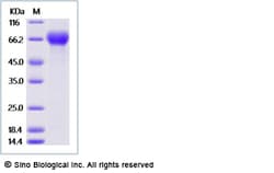 Sino Biological Recombinant Human ILT-8/LILRA6 Protein (His Tag), Quantity: