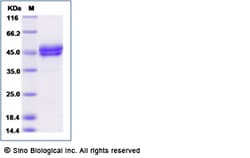 Sino Biological IgE Fc Protein, Human, Recombinant (His Tag), Quantity: