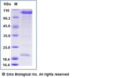 Sino Biological Recombinant Human PCSK9 Protein (D374Y, mFc Tag), Amine-Labeled