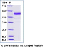 Sino Biological Recombinant Human EGFR Protein (ECD, Isoform vIII, His