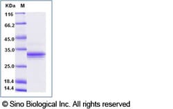 Sino Biological Recombinant Human IL-20R beta/IL-20RB Protein (ECD, His