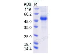 Sino Biological Recombinant Human PVRIG Protein (hFc Tag), Quantity: Each