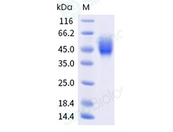 Sino Biological Recombinant Human GFRAL Protein (His Tag), HPLC-verified,