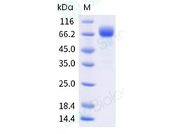 Sino Biological Recombinant Human GFRAL Protein (hFc Tag), HPLC-verified,