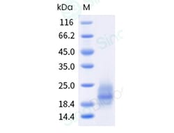 Sino Biological Recombinant Human LY6G6D Protein (His Tag), Quantity: Each