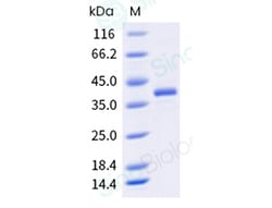 Sino Biological Recombinant Human LY6G6D Protein (hFc Tag), Quantity: Each