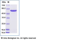 Sino Biological Recombinant Human FTCD Protein (His Tag), Quantity: Each