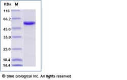 Sino Biological Recombinant Human SRP54 Protein (His Tag), Quantity: Each