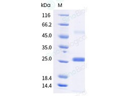 Sino Biological Recombinant HSV-1 gG-CE, Quantity: Each of 1