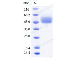 Sino Biological Recombinant HSV-1 gD N1, Quantity: Each of 1