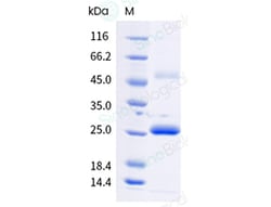 Sino Biological Recombinant CMV pp150 C2, Quantity: Each of 1