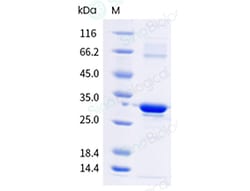 Sino Biological Recombinant CMV pp150-C1, Quantity: Each of 1