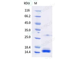 Sino Biological Recombinant Toxoplasma gondii SAG2 & SAG3 Protein, Quantity: