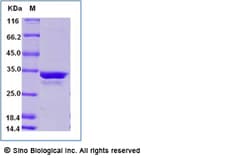 Sino Biological Recombinant Human NUP210 Protein (GST Tag), Quantity: Each
