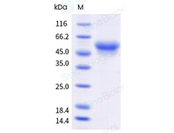 Sino Biological Recombinant Human Siglec-8 Protein (ECD, His Tag), HPLC-verified,