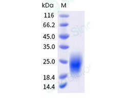 Sino Biological Recombinant Human GIPR Protein (His & AVI Tag), Biotinylated,